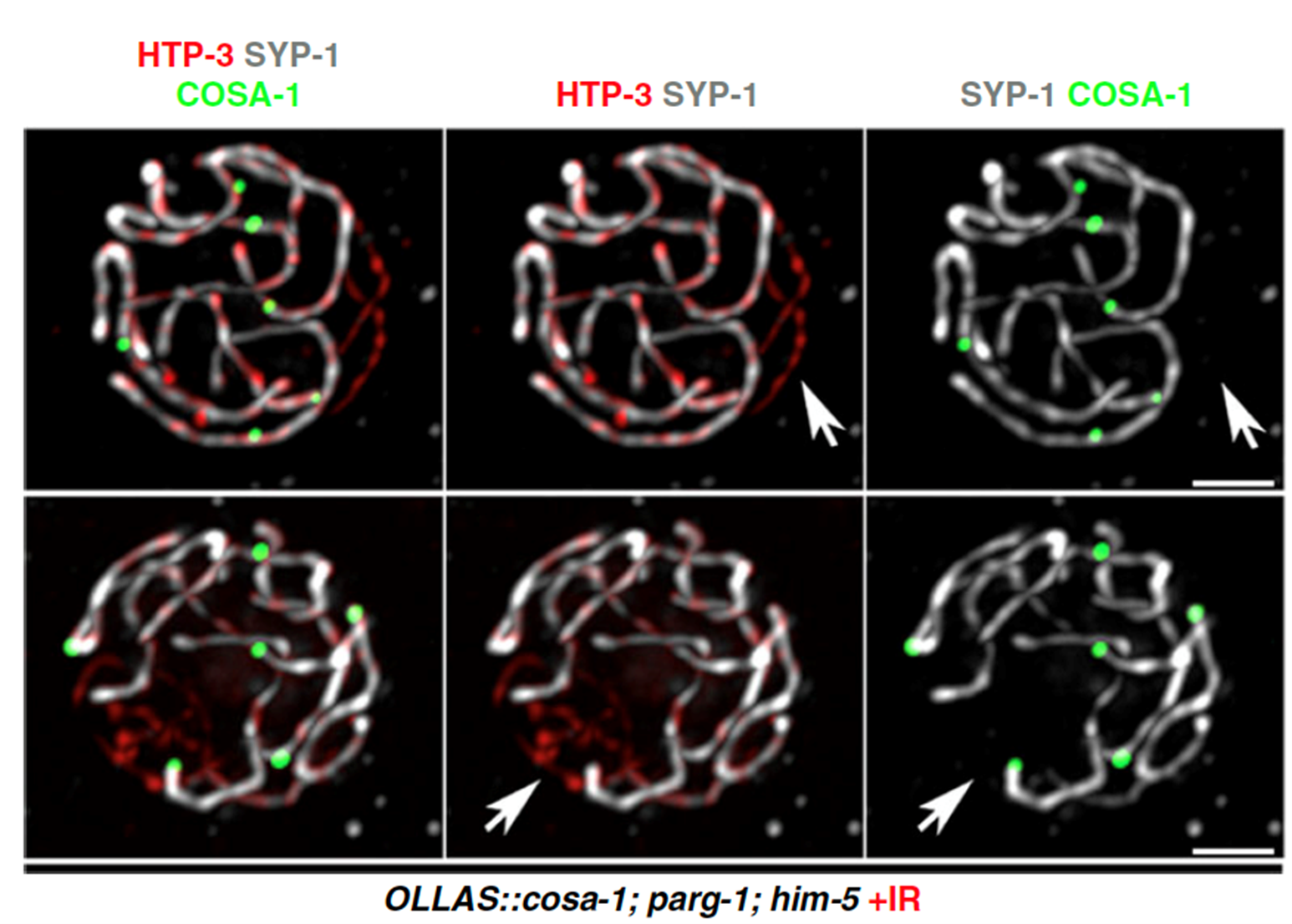 Image 2: Oocytes stained for different SC subunits and the crossover sites in mutants with reduced DSBs, after irradiation. From Janisiw et al.; Nature Communications, 2020.